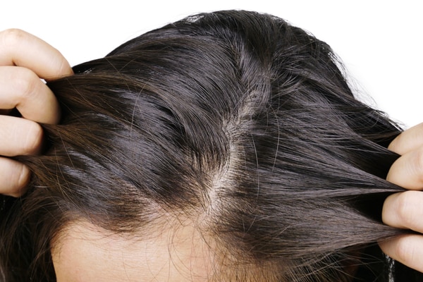 Biotech Scalp Care Solutions