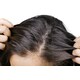 Biotech Scalp Care Solutions Image 1