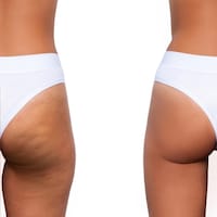 Biotech Body Sculpting