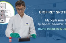 Rapid Mycoplasma Detection Systems