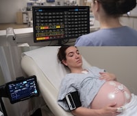 Continuous Maternal Monitoring Systems Image 1