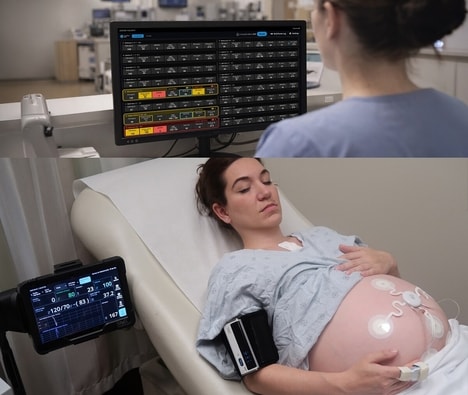 Continuous Maternal Monitoring Systems