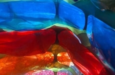 Participatory Plastic-Upcycling Projects