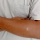 Lactose Relief Patches Image 4