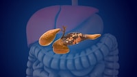 Predictive Cancer AI Image 1