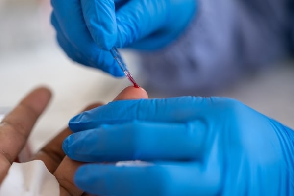 Decentralized Diagnostic Testing