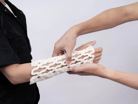 Waterproof Lattice-Style Healthcare Casts