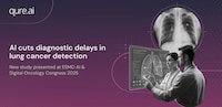 AI-Enabled Lung Screening Solutions Image 1