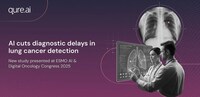 AI-Enabled Lung Screening Solutions