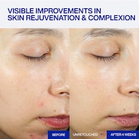 Energizing BIO-PDRN Caffeine Serums Image 5