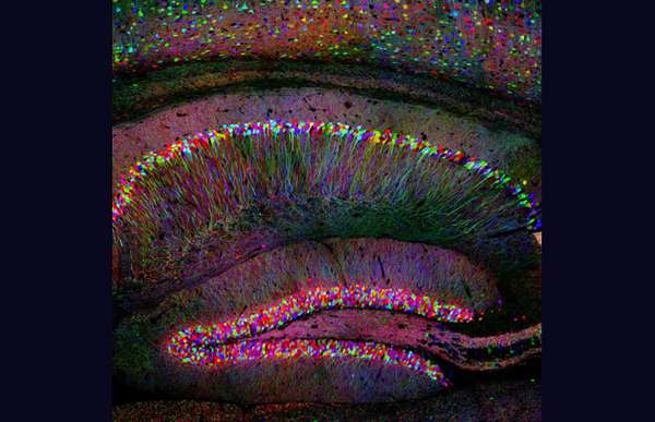 Colorful Brain Scans Image 2