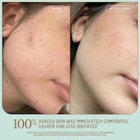 Squalane-Powered Gel Moisturizers Image 6
