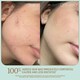 Squalane-Powered Gel Moisturizers Image 6