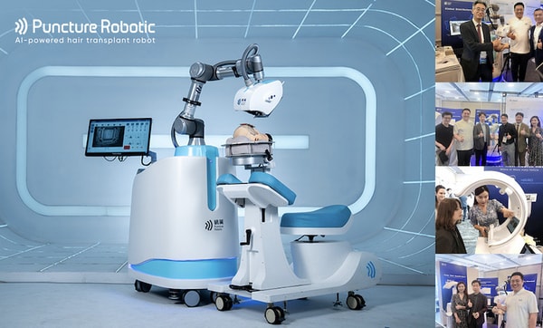 AI-Powered Hair Transplant Robots