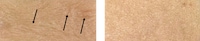 Elasticity-Promoting Cosmetic Ingredients Image 2