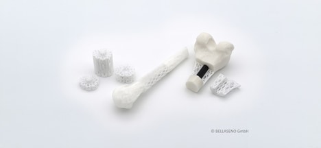 Bioresorbable Bone Implants