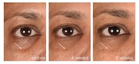 Biointelligent Undereye Serums Image 2