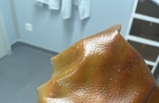 Living Fungal Textiles