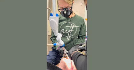 Digital Dentistry Lasers