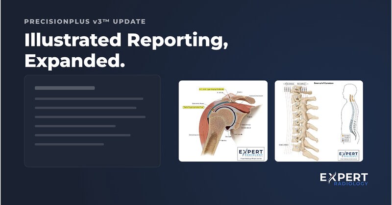 Illustrated Radiology Reports Article Thubnail