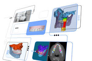 AI Dental Imaging Integrations Article Thubnail