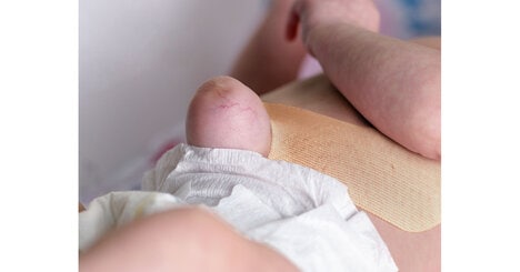 Non-Invasive Pediatric Supports