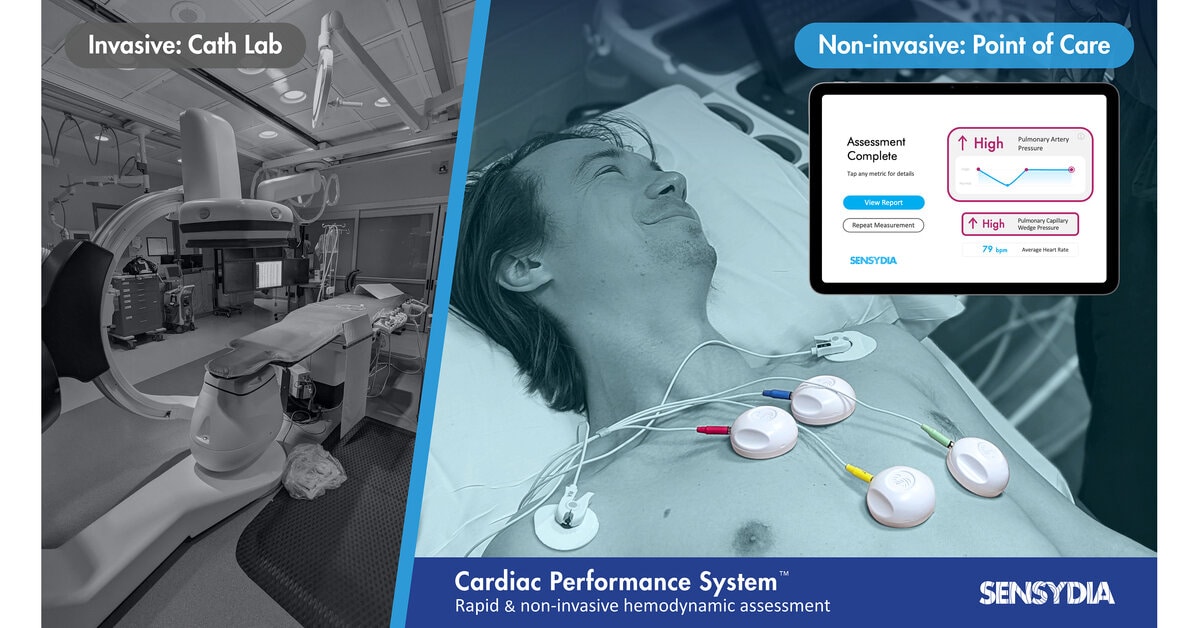 Sensydia raises $6 million to push catheter‑free cardiac device toward FDA review