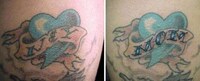 Inked Body Art Corrections Image 7
