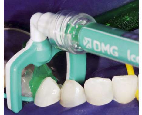 26 Teeth Cleaning Creations