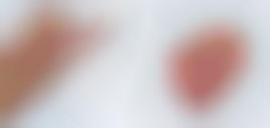 Implantable Glucose Sensors