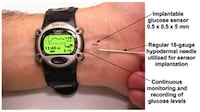 Implantable Glucose Sensors Image 2