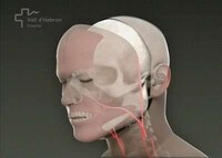 Face Transplants Image 3