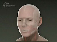Face Transplants Image 4