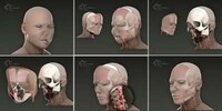 Face Transplants Image 7