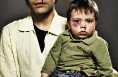 Battered Self-Portraits