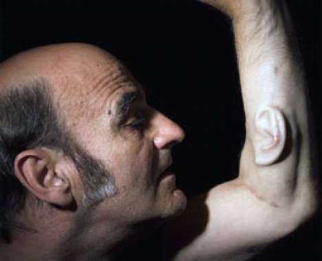 49 Incredible Implants & Transplants