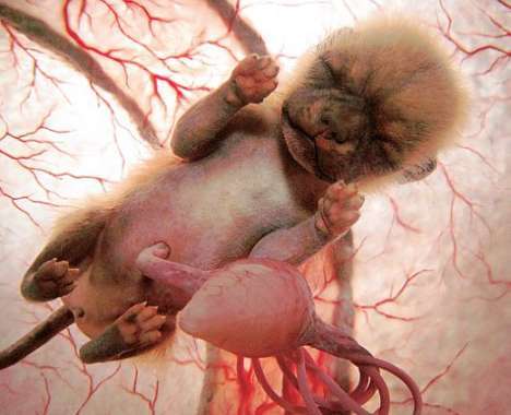 21 Incredible Fetal Innovations