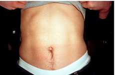 Belly-Baring Photography