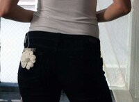 Insulin Pump Accessories Image 2