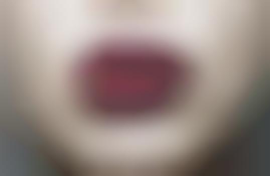 Bejewelled Crimson Lips