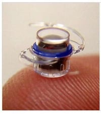 Telescopic Eyeball Implants Image 3