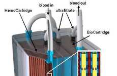 Engineered Organ Transplants