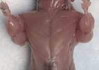 Genetically Altered Muscles