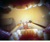 In-Mouth Camera Photos Image 2