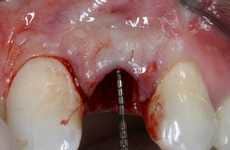 Speedy Oral Improvements