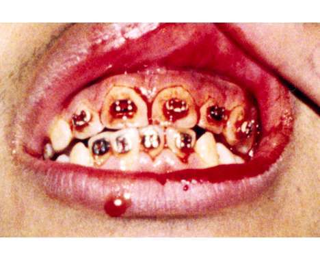 25 Blood-Drenched Editorials