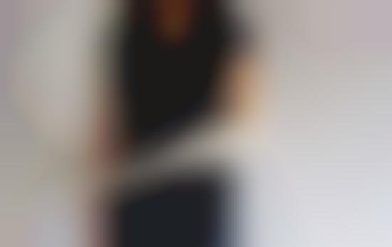 Alienesque Prosthetic Arms