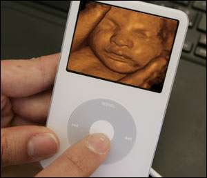 Your Fetus on an iPod