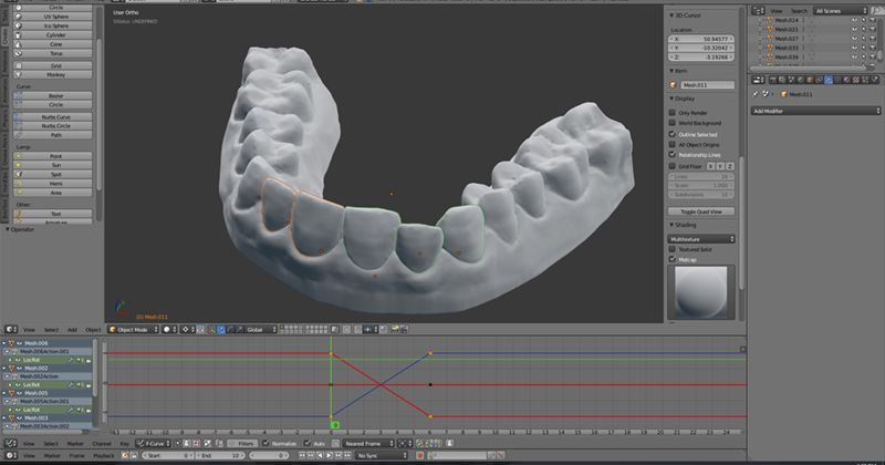 Inexpensive 3D-Printed Braces