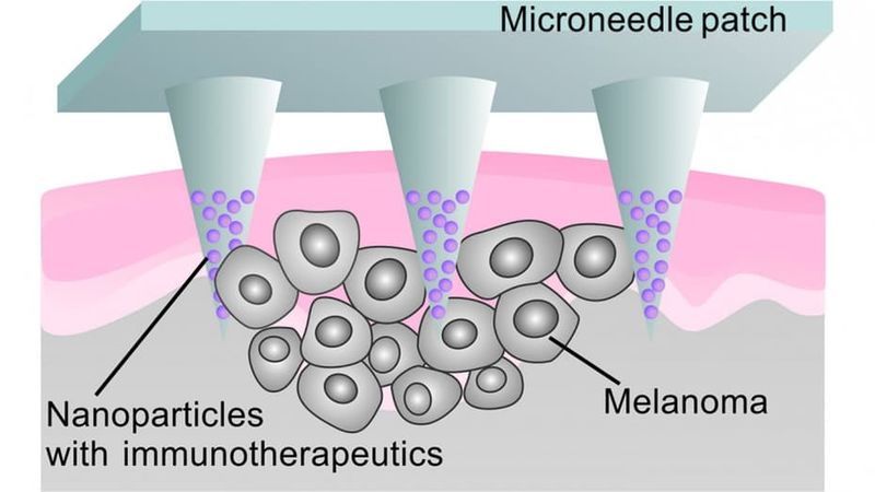 Tumor-Neutralizing Patches